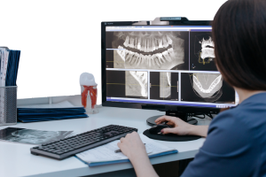Immediate Load Dental Implants
